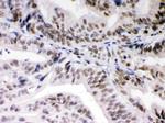 DAXX Antibody in Immunohistochemistry (Paraffin) (IHC (P))