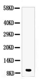 DBI Antibody in Western Blot (WB)