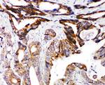 DCC Antibody in Immunohistochemistry (Paraffin) (IHC (P))