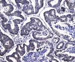 DCK Antibody in Immunohistochemistry (Paraffin) (IHC (P))