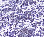 DCK Antibody in Immunohistochemistry (Paraffin) (IHC (P))