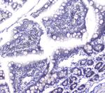 DCK Antibody in Immunohistochemistry (Paraffin) (IHC (P))