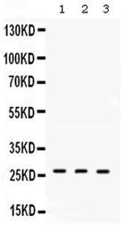 DDAH2 Antibody in Western Blot (WB)