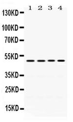 DDB2 Antibody in Western Blot (WB)