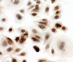 DDX4 Antibody in Immunocytochemistry (ICC/IF)