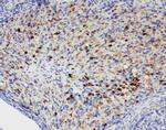 DDX4 Antibody in Immunohistochemistry (Paraffin) (IHC (P))