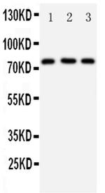 DDX4 Antibody in Western Blot (WB)