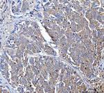 Dicer Antibody in Immunohistochemistry (Paraffin) (IHC (P))