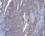 Dicer Antibody in Immunohistochemistry (Paraffin) (IHC (P))