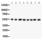 DLD Antibody in Western Blot (WB)