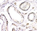 DMRT1 Antibody in Immunohistochemistry (Paraffin) (IHC (P))