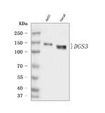 Desmoglein 3 Antibody in Western Blot (WB)