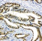 DUT Antibody in Immunohistochemistry (Paraffin) (IHC (P))