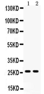 DUT Antibody in Western Blot (WB)