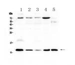 DYNLT1 Antibody in Western Blot (WB)