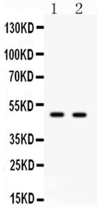 E2F3 Antibody in Western Blot (WB)