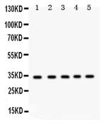 EBAG9 Antibody in Western Blot (WB)