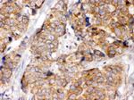 eIF4A2 Antibody in Immunohistochemistry (Paraffin) (IHC (P))