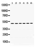 eIF4A2 Antibody in Western Blot (WB)