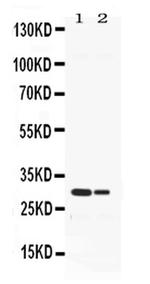 Neutrophil elastase Antibody in Western Blot (WB)