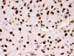 HuD Antibody in Immunohistochemistry (Paraffin) (IHC (P))