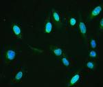 Emerin Antibody in Immunocytochemistry (ICC/IF)