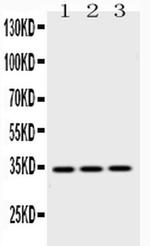 Emerin Antibody in Western Blot (WB)