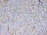 CD105 (Endoglin) Antibody in Immunohistochemistry (Paraffin) (IHC (P))