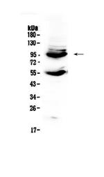 CD105 (Endoglin) Antibody in Western Blot (WB)