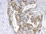 EpCAM (CD326) Antibody in Immunohistochemistry (Paraffin) (IHC (P))