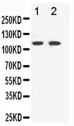 EphB3 Antibody in Western Blot (WB)