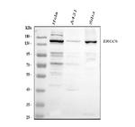 CSB Antibody in Western Blot (WB)