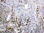 FABP2 Antibody in Immunohistochemistry (Paraffin) (IHC (P))