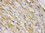 FABP2 Antibody in Immunohistochemistry (Paraffin) (IHC (P))