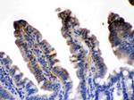 FABP2 Antibody in Immunohistochemistry (Paraffin) (IHC (P))