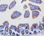 FAS (CD95) Antibody in Immunohistochemistry (Paraffin) (IHC (P))