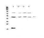 CD64 Antibody in Western Blot (WB)