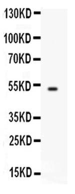 FCGRT Antibody in Western Blot (WB)