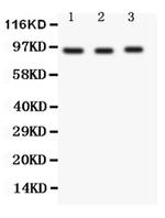 FER Antibody in Western Blot (WB)