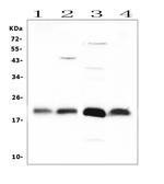 FGF21 Antibody in Western Blot (WB)