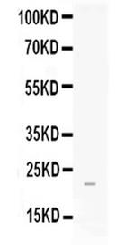 FGF21 Antibody in Western Blot (WB)