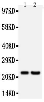 FGF9 Antibody in Western Blot (WB)