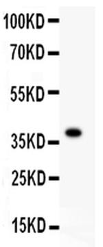 FGFR4 Antibody in Western Blot (WB)