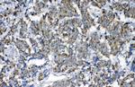 Fumarase Antibody in Immunohistochemistry (Paraffin) (IHC (P))