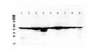 Fumarase Antibody in Western Blot (WB)