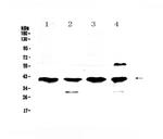 VEGFD Antibody in Western Blot (WB)