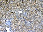 FLT3 (CD135) Antibody in Immunohistochemistry (Paraffin) (IHC (P))