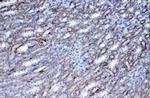 FLT3 (CD135) Antibody in Immunohistochemistry (Paraffin) (IHC (P))