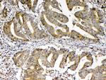 FZD3 Antibody in Immunohistochemistry (Paraffin) (IHC (P))