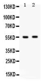 GABRB3 Antibody in Western Blot (WB)